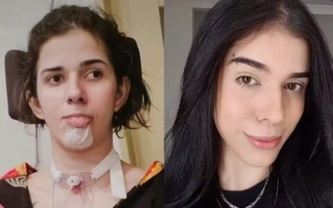 Três anos após tragédia em Anápolis, mãe relembra luta de filha que ficou com graves sequelas