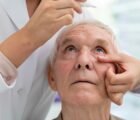 Glaucoma pode causar cegueira irreversível sem dar nenhum sinal, alerta oftalmologista
