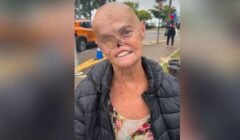 Mulher diagnosticada com 73 tumores emociona redes sociais: 'Sou mais forte e venci'