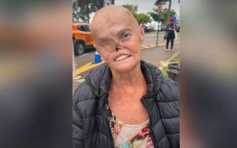 Mulher diagnosticada com 73 tumores emociona redes sociais: 'Sou mais forte e venci'