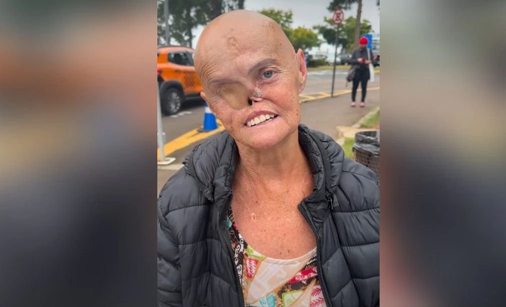 Mulher diagnosticada com 73 tumores emociona redes sociais: 'Sou mais forte e venci'