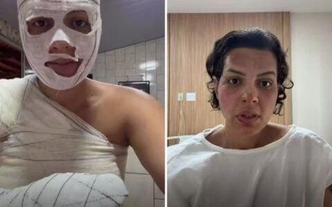 Nutricionista sofre queimaduras após explosão durante faxina