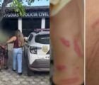 Suspeitos filmam espancamento de mulher trans e acabam presos em Goiás
