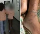 Homem mantido acorrentado pela mãe em Rio Verde sofreu três AVCs