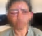 Homem invade casa em Cristalina e estrangula mulher com toalha