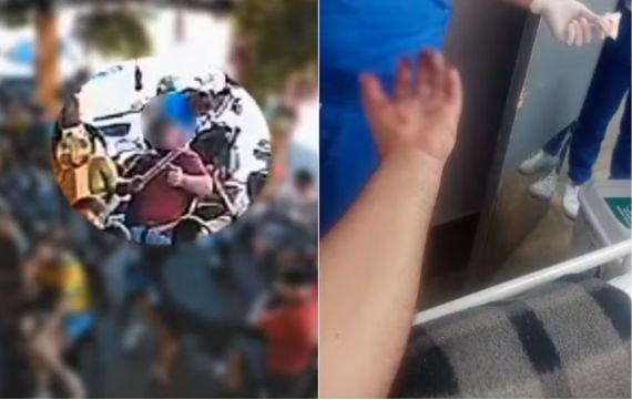 Torcedor fica com a mão dilacerada após rojão explodir em bar de Goiás