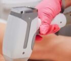 Depilação a laser em Goiânia termina com queimaduras e indenização
