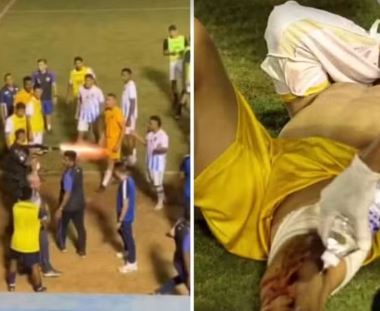 Goleiro atingido por tiro de PM em Anápolis receberá R$ 97 mil do Estado